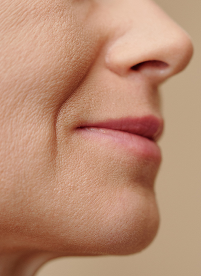 Kinnvergrößerung, Dr. Deb, Central Aesthetics, Plastische Chirurgie & Schönheitschirurgie in Frankfurt