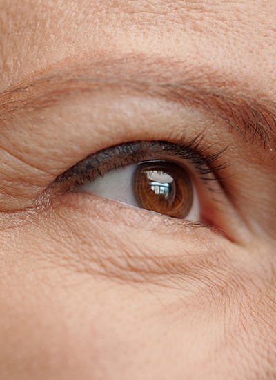 Oberlidstraffung, Dr. Deb, Central Aesthetics, Plastische Chirurgie & Schönheitschirurgie in Frankfurt