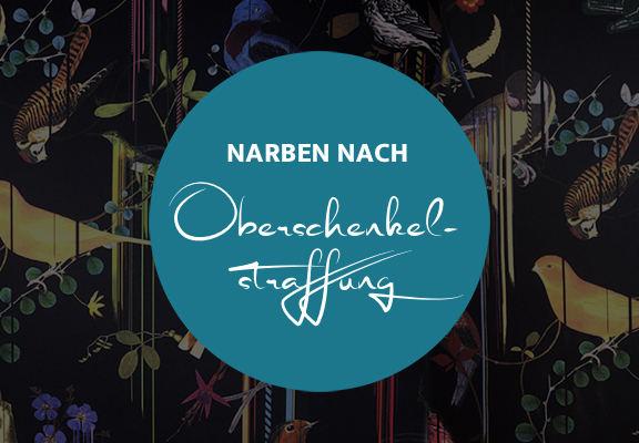Narben nach Oberschenkelstraffung, Dr. Deb, Plastische Chirurgie & Schönheitschirurgie in Frankfurt 