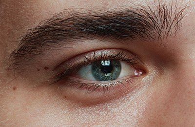 Augenlidstraffung in Frankfurt, Central Aesthetics