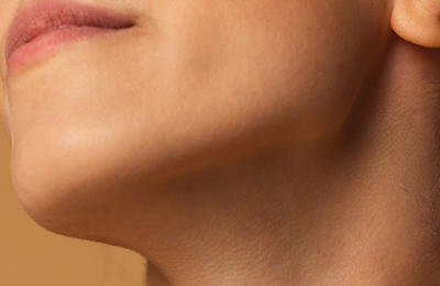 Doppelkinn entfernen in Frankfurt, Central Aesthetics