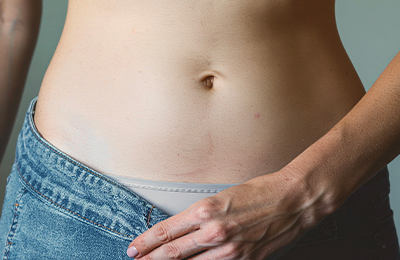 Fett-weg-Spritze in Frankfurt, Central Aesthetics