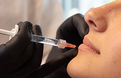 Lippen aufspritzen in Frankfurt, Central Aesthetics